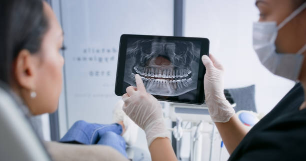 Licensed Dental Veneers service in Los Ranchos de Albuquerque, NM - Smile Center Dentistry